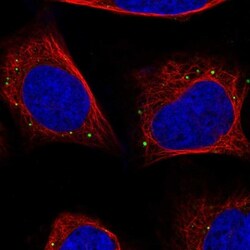 JNK/JIP3 Antibody, Novus Biologicals 25 &mu;L, Unlabeled:Antibodies, Polyclonal
